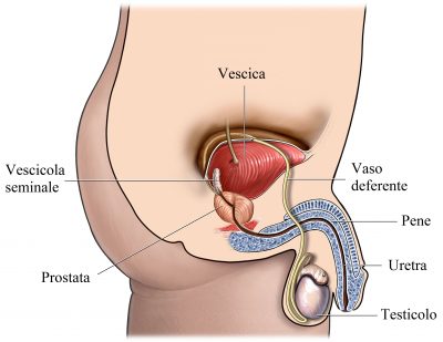 Adenom de prostata: cauze, simptome, complicatii, tratament | Bioclinica